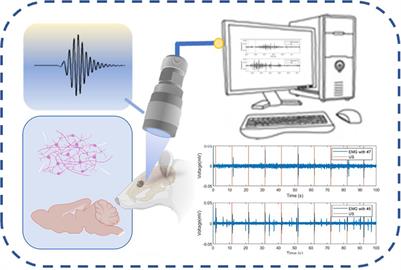 An Optimized Miniaturized Ultrasound Transducer for Transcranial Neuromodulation